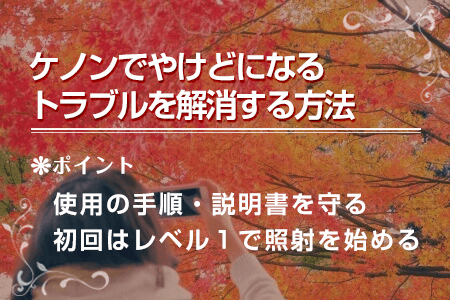 4-2.ケノンでやけどになるトラブルを解消する方法